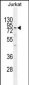ELMO2 Antibody (Center)